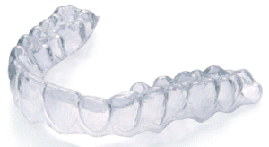 nakładki-ortodoncja Clear Aligner