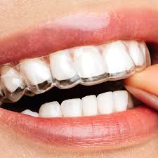 Clear Aligner