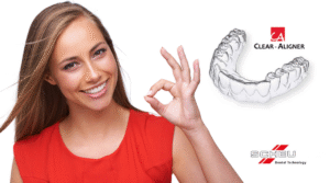 nakładki-ortodoncja Clear Aligner