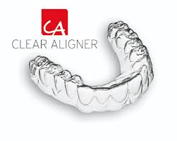 Clear Aligner
